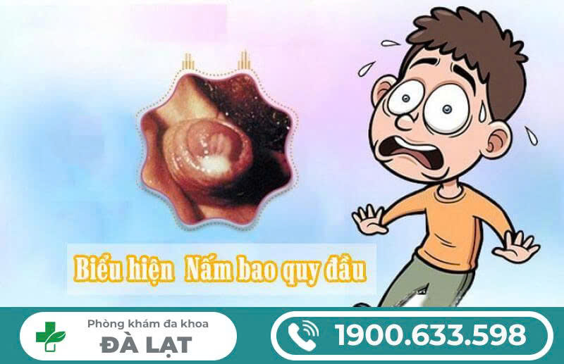 Hình ảnh minh họa